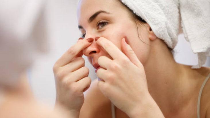 Komedonları tarihe gömün! 2 malzemeyi karıştırın, her gün uygulayınca iş bitiyor